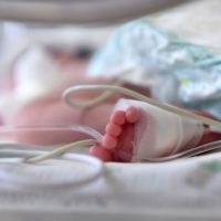 Birth Injury Lawsuits