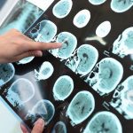 BrainScan BrainScan