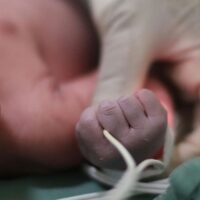 Coral Gables Pediatric Medical Injury Attorney