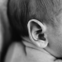 Orlando Erb's Palsy Attorney