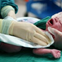 Jupiter Birth Injury Attorney