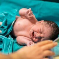 Miami Periventricular Leukomalacia Attorney