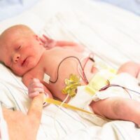 Pompano Beach Birth Injury Attorney