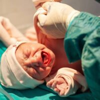 Miami Intraventricular Hemorrhage Attorney