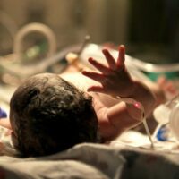 Fontainebleau Birth Injury Lawyer