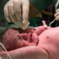 Homestead Birth Injury Attorney