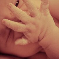 Miami Gardens Birth Injury Lawyer