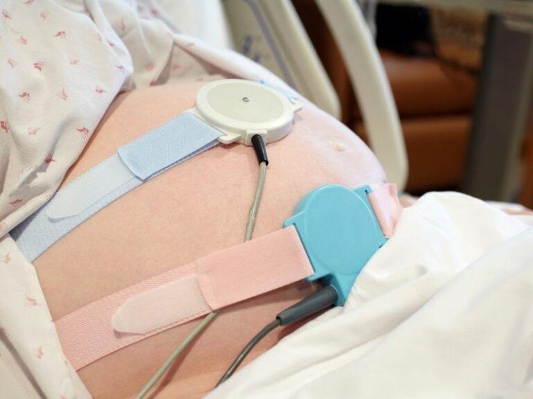 Fetal Monitoring